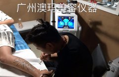 美國(guó)蜂巢皮秒多少價(jià)位?洗紋身機(jī)器什么牌子_一臺(tái)洗紋身機(jī)多少錢