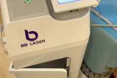 BB laser素顏光國(guó)內(nèi)哪個(gè)生產(chǎn)廠家比較好？進(jìn)口素顏光設(shè)備代理商
